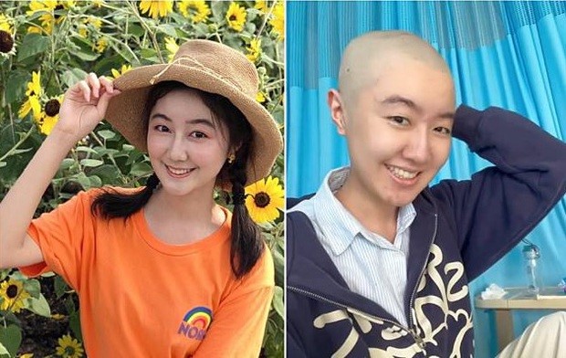 ngoi sao nhi duoc yeu thich nhat trung quoc phau thuat u nao thanh cong1 ngoi sao nhi duoc yeu thich nhat trung quoc phau thuat u nao thanh cong1