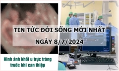 Tin tức đời sống ngày 8/7/2024: Khám sức khỏe định kỳ, phát hiện khối u “khủng”
