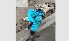 Tin tức đời sống ngày 18/7/2024: Cứu bé 7 tuổi chấn thương sọ não nguy kịch