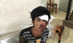 Tin tức thời sự mới nóng nhất hôm nay 16/10: Bị truy đuổi, tên cướp tông vào dải phân cách bất tỉnh
