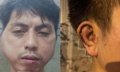 Hà Nội: Khởi tố nhóm đối tượng đánh nhân viên quán nướng biến dạng mặt