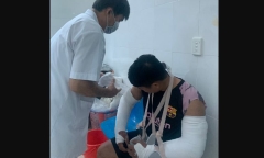 Quảng Ngãi: Hai vợ chồng dùng tuýp sắt, ghế inox đánh gãy hai tay shipper