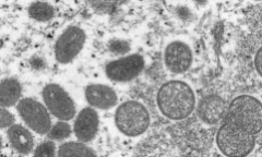 Mỹ chi hơn 100 triệu USD mua vaccine phòng virus gây bệnh đậu mùa khỉ