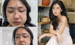 Bạn trai đăng bài xin lỗi MC Misoa Kim Anh sau khi tác động vật lý với người yêu
