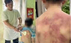 Tạm giữ hình sự người đàn ông ở Đồng Nai hành hạ dã man con trai ruột