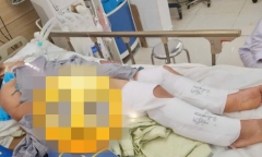 9 người bị rắn độc và côn trùng độc cắn vào đêm bão số 3