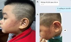 Vụ cô giáo đánh bé trai tím má vì ngủ ngáy: Nhà học sinh bị kẻ lạ ném chất bẩn 