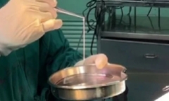 Người đàn ông mắc động kinh 20 năm, kết quả chụp não hé lộ thứ