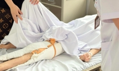 Xây xước khi chơi đá bóng, nam thanh niên 15 tuổi nhiễm trùng nặng phải 