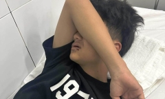 Điều tra vụ đi tắm biển, thiếu niên 14 tuổi ở Đà Nẵng bị người lạ đánh gãy 4 răng
