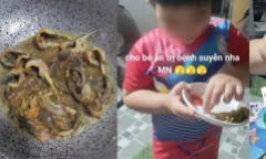 Xôn xao việc dùng thằn lằn trị hen suyễn cho trẻ: Bác sĩ lên tiếng cảnh báo