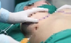 Diễn biến mới nhất vụ bác sĩ nâng ngực chui khiến cô gái trẻ tử vong, đưa thi thể ra trại hòm