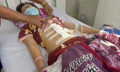 Tình tiết mới vụ thiếu nữ 16 tuổi nghi bị cha dượng đánh dập lá lách, gãy xương sườn