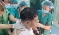 Người đàn ông bị đoạn gỗ keo đâm vào ngực phải làm gãy 4 xương sườn