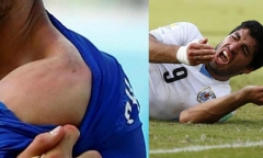Cắn Chiellini, Suarez bị treo giò 4 tháng, mất World Cup 2014