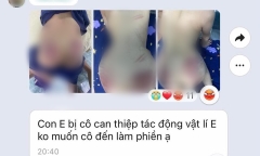 Hà Nội: Xác minh thông tin cháu bé 9 tuổi nghi bị cô giáo dạy can thiệp bạo hành