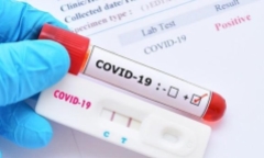 Tin tức thời sự mới nóng nhất 7/3: Bộ Y tế nêu nguyên nhân kit test khan hàng