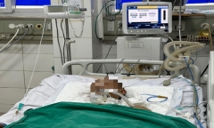 Sau 15 ngày gạch rơi trúng chân, nam thanh niên xuất hiện triệu chứng cứng hàm, khó nói