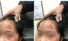 Diễn biến mới nhất vụ nữ sinh lớp 6 bị bạn hành hung ở Hà Nội