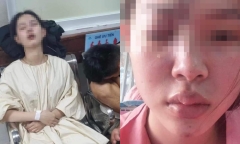 Vụ thiếu nữ mù một mắt, liệt nửa mặt sau khi làm mũi: Bác sĩ lý giải nguyên nhân