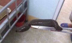 Đi mò ốc dưới ao, cụ ông bị con đỉa dài 15cm chui vào dương vật