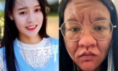 Cô gái gây sốc vì gương mặt thay đổi không nhận ra khi mang thai!