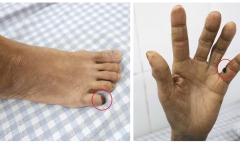 Hút mỡ kéo dài 8 giờ ở cơ sở tư nhân, người phụ nữ nhập viện lúc nửa đêm