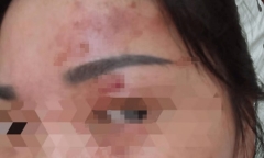 Cách nấu cháo bồ câu bằng nồi cơm điện