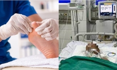 Vật cứng rơi vào chân, người đàn ông xuất hiện cứng hàm, khó nuốt