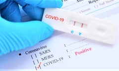 Có nên test nhanh COVID-19 ngay sau khi tiếp xúc với F0?