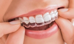 Niềng răng bao lâu thì có hàm răng đều đẹp? Thời điểm và những lưu ý khi niềng răng