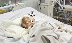 Vụ bé trai xuất huyết não bất thường tại điểm giữ trẻ tự phát tại Quảng Ngãi: Công an vào cuộc