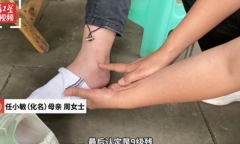 Nữ sinh 13 tuổi bị thương tật vĩnh viễn chỉ vì gói đồ ăn vặt trong phòng ký túc xá