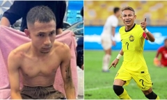 Đội trưởng tuyển Malaysia bị kẻ lạ mặt tạt axit, bỏng cấp độ 2