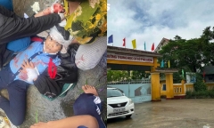 Tình hình sức khỏe của nữ sinh lớp 6 bị gã thanh niên dùng búa đánh vào đầu