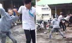 Nam sinh ở Đắk Lắk nhập viện sau khi bị bạn dùng mũ bảo hiểm đánh