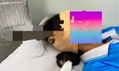 Đang uống nước trong sân trường, một nữ sinh ở Kiên Giang bị lưỡi dao găm trúng đầu