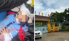 Vụ nữ sinh lớp 6 bị gã thanh niên dùng búa đánh vào đầu: Chuyển hồ sơ để điều tra hành vi 