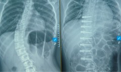 Ca phẫu thuật lần đầu tiên có ở Việt Nam