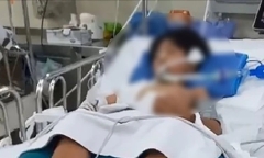 Dừng đèn đỏ, bé trai 10 tuổi bị nhánh cây khô rơi trúng đầu, chấn thương nặng