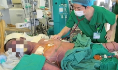 Người đàn ông hoại tử toàn thân tiên lượng xấu vì ăn món quen thuộc