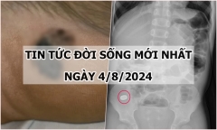 Tin tức đời sống ngày 4/8/2024: Phát hiện mắc ung thư từ nốt đen ở gần gót chân