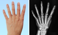 7 đặc điểm đột biến độc đáo trên cơ thể không phải ai cũng may mắn sở hữu