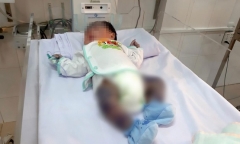 Tin tức đời sống ngày 10/6: Cứu sống bé trai 13 ngày tuổi bị thủy đậu toàn thân