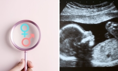 Hy hữu: Đang làm phẫu thuật chuyển giới nam thì phát hiện mang thai 5 tháng