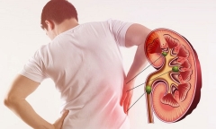 Những hành động người Việt vẫn vô tư làm hàng ngày mà không biết chúng gây hại cho thận