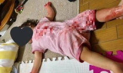 Người con gái dính đầy vết đỏ như máu, bố mẹ hoảng hốt rồi “tăng xông” khi biết sự thật