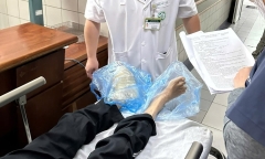 Chữa tê bì bằng cách châm điện, người đàn ông nhập viện trong tình trạng bàn chân bốc mùi hôi thối
