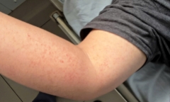 Từ “cửa tử” trở về: Những ca đột quỵ hồi phục kỳ diệu trong đợt giá rét