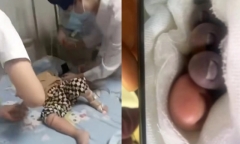 Bé 2 tuổi nhiễm vi khuẩn ăn thịt người do nghịch cá ở chợ: Cảnh báo nguy hiểm tiềm ẩn